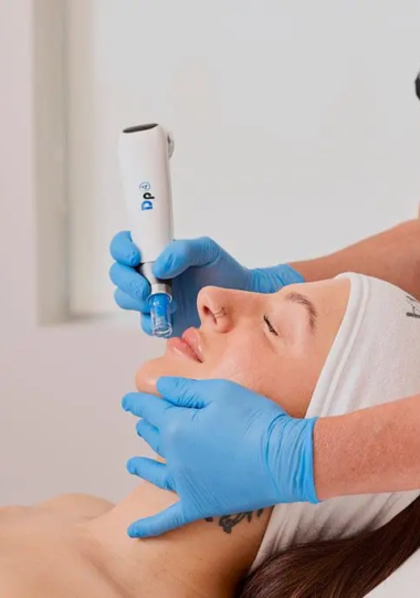 Exosomes visage
